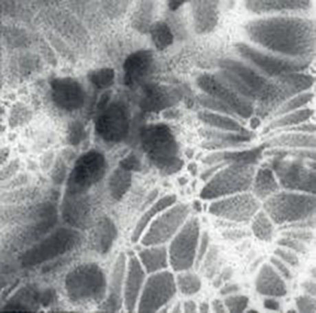 Palimpsest Doily Fragment #7_Ashley V Blalock460 Ashley V. Blalock